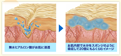 海のブレア Wモイスチャーの保湿クリームを買う時に比較した化粧品